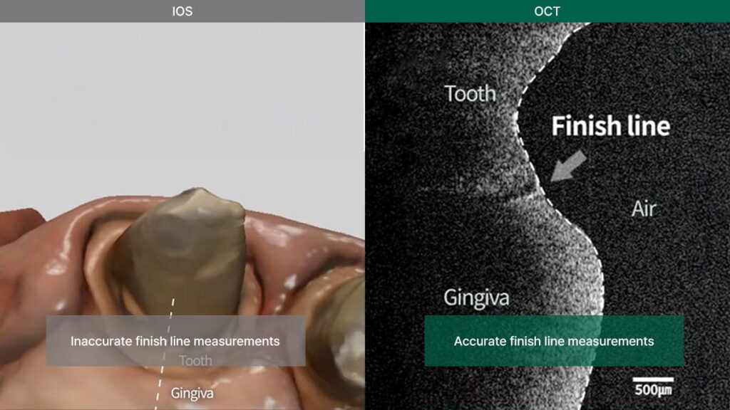 Digital interface showing the integration of OCT data for precision diagnostics and enhanced restorative outcomes in Lilivis digital dentistry.