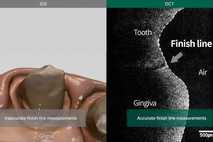 Digital interface showing the OCT integrated scanning process for enhanced diagnostic precision in Lilivis digital dentistry.