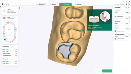 L-CAD interface parameter stage showing cement gap setting for precise tooth block fitting.