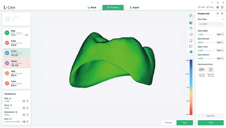 L-CAM interface simulation of the final product with 3D color-coded tooth accuracy analysis.