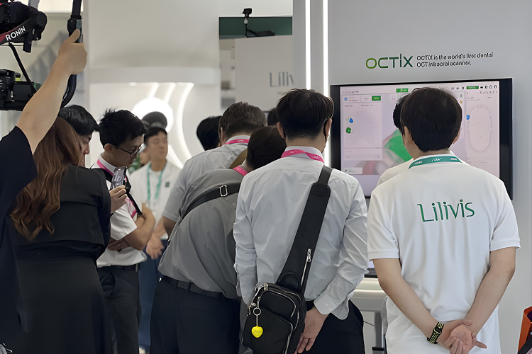 Lilivis team showcasing the world's first OCT-based intraoral scanner OCTiX at SIDEX 2025