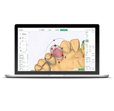 Connect every stage of digital dentistry with intuitive software for scanning, CAD design, data management, and manufacturing.