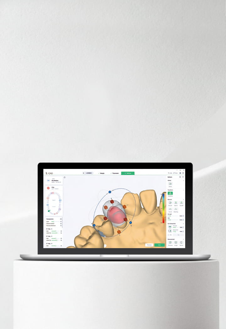 Laptop showing L-CAD dental design software on a white stage.