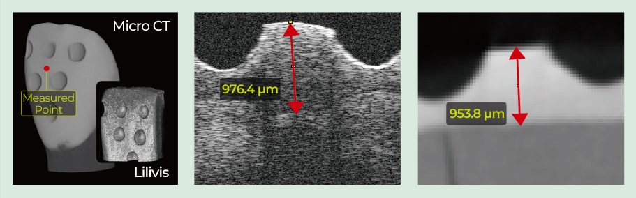 accuracy-of-measured enamel-layer-after-fit